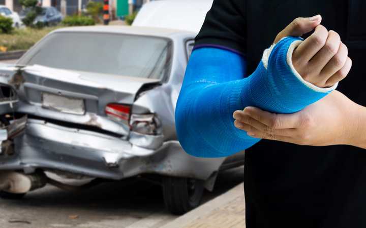 Car Accidents: What Possible Compensation for Bodily Injury?
